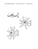 BASKET STYLE CARDIAC MAPPING CATHETER HAVING AN ATRAUMATIC BASKET TIP FOR     DETECTION OF CARDIAC RHYTHM DISORDERS diagram and image