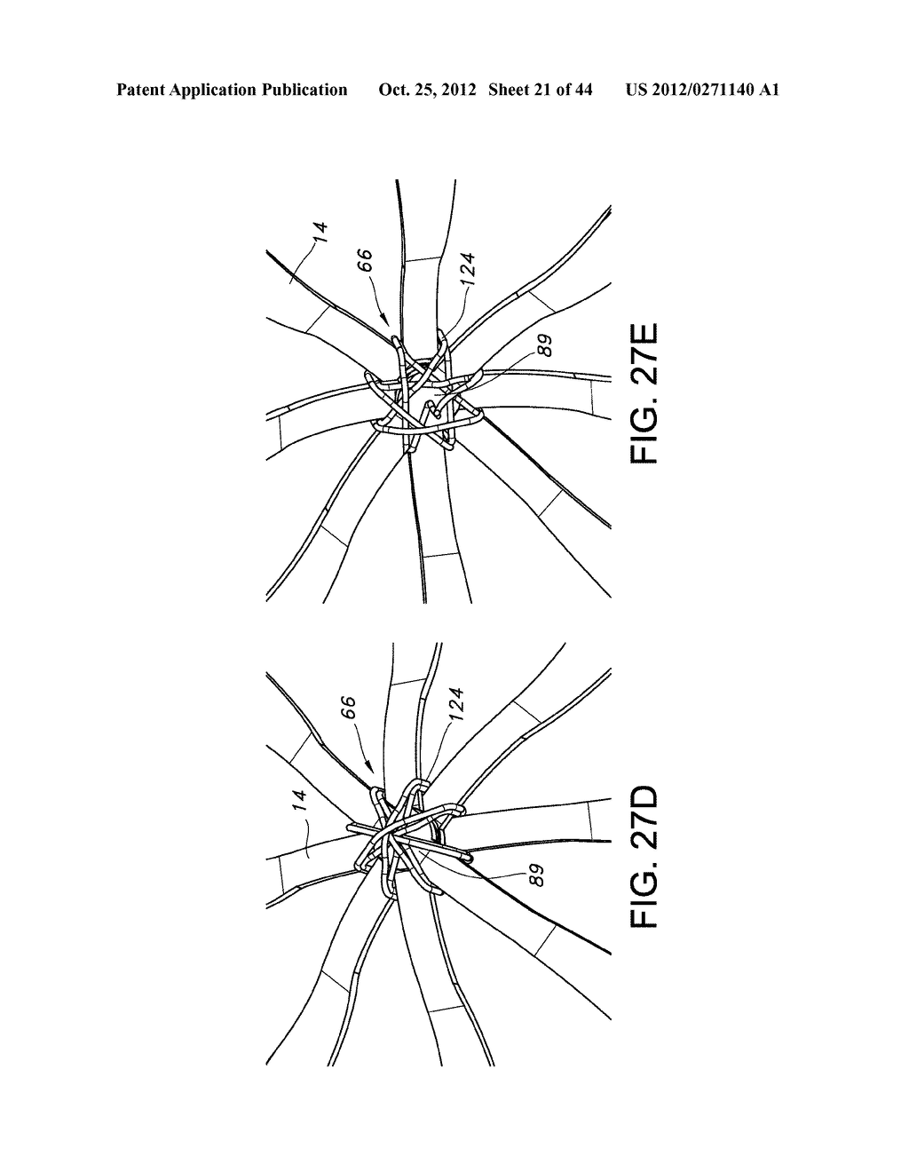 BASKET STYLE CARDIAC MAPPING CATHETER HAVING AN ATRAUMATIC BASKET TIP FOR     DETECTION OF CARDIAC RHYTHM DISORDERS - diagram, schematic, and image 22