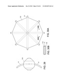 BASKET STYLE CARDIAC MAPPING CATHETER HAVING AN ATRAUMATIC BASKET TIP FOR     DETECTION OF CARDIAC RHYTHM DISORDERS diagram and image