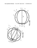 BASKET STYLE CARDIAC MAPPING CATHETER HAVING AN ATRAUMATIC BASKET TIP FOR     DETECTION OF CARDIAC RHYTHM DISORDERS diagram and image