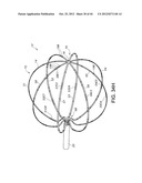 BASKET STYLE CARDIAC MAPPING CATHETER HAVING AN ATRAUMATIC BASKET TIP FOR     DETECTION OF CARDIAC RHYTHM DISORDERS diagram and image