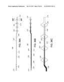 BASKET STYLE CARDIAC MAPPING CATHETER HAVING AN ATRAUMATIC BASKET TIP FOR     DETECTION OF CARDIAC RHYTHM DISORDERS diagram and image