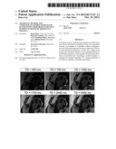 APPARATUS, METHOD, AND COMPUTER-ACCESSIBLE MEDIUM FOR B1-INSENSITIVE HIGH     RESOLUTION 2D T1 MAPPING IN MAGNETIC RESONANCE IMAGING diagram and image