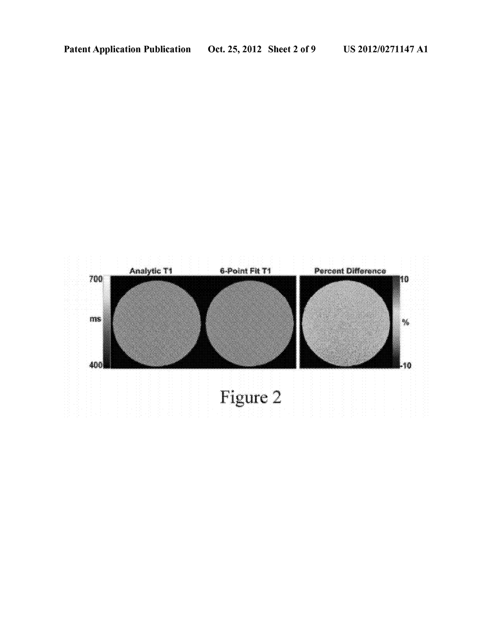 APPARATUS, METHOD, AND COMPUTER-ACCESSIBLE MEDIUM FOR B1-INSENSITIVE HIGH     RESOLUTION 2D T1 MAPPING IN MAGNETIC RESONANCE IMAGING - diagram, schematic, and image 03