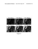 APPARATUS, METHOD, AND COMPUTER-ACCESSIBLE MEDIUM FOR B1-INSENSITIVE HIGH     RESOLUTION 2D T1 MAPPING IN MAGNETIC RESONANCE IMAGING diagram and image