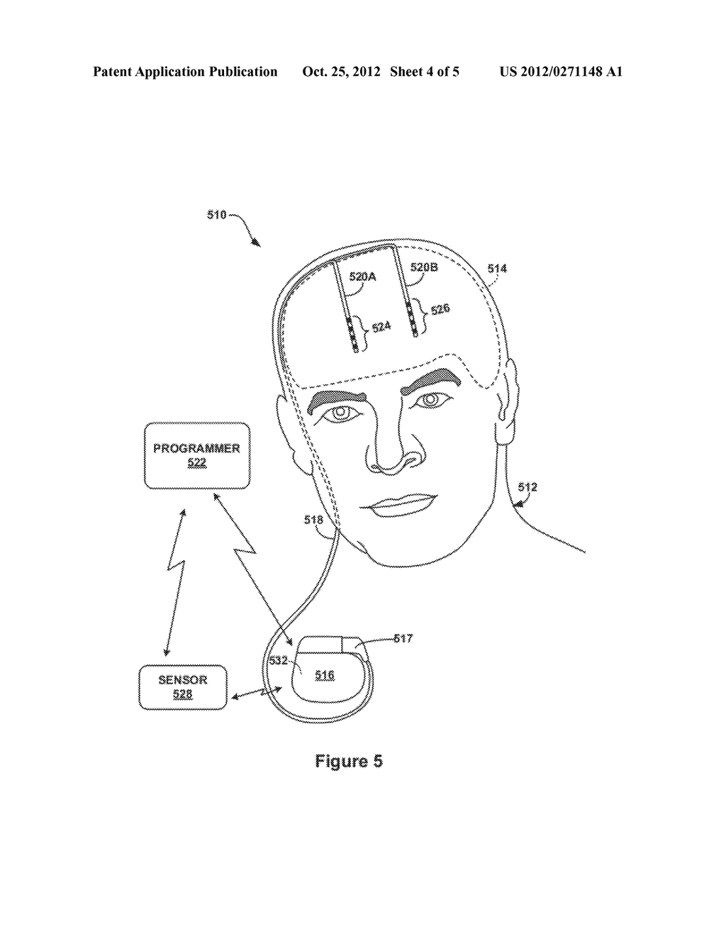 BRAIN CONDITION MONITORING BASED ON CO-ACTIVATION OF NEURAL NETWORKS - diagram, schematic, and image 05