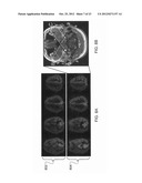 MAPPING VASCULAR PERFUSION TERRITORIES USING MAGNETIC RESONANCE IMAGING diagram and image