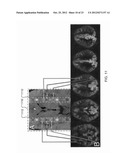 MAPPING VASCULAR PERFUSION TERRITORIES USING MAGNETIC RESONANCE IMAGING diagram and image