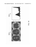 MAPPING VASCULAR PERFUSION TERRITORIES USING MAGNETIC RESONANCE IMAGING diagram and image