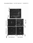 MAPPING VASCULAR PERFUSION TERRITORIES USING MAGNETIC RESONANCE IMAGING diagram and image