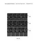 MAPPING VASCULAR PERFUSION TERRITORIES USING MAGNETIC RESONANCE IMAGING diagram and image