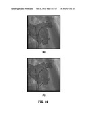 Constrained Registration for Motion Compensation in Atrial Fibrillation     Ablation Procedures diagram and image