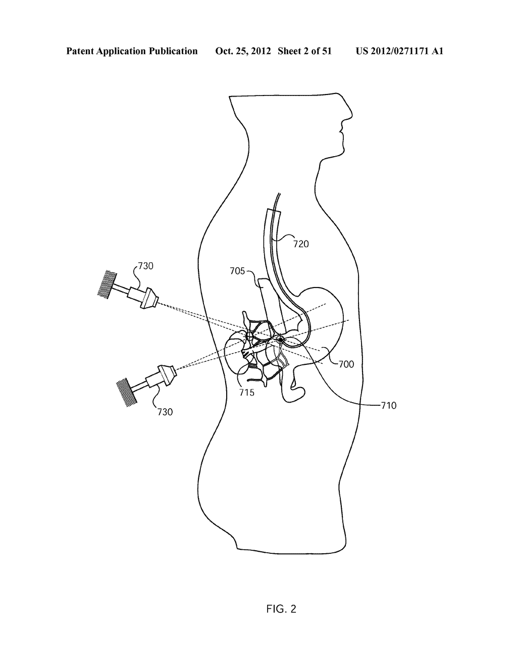 ENERGETIC MODULATION OF NERVES - diagram, schematic, and image 03