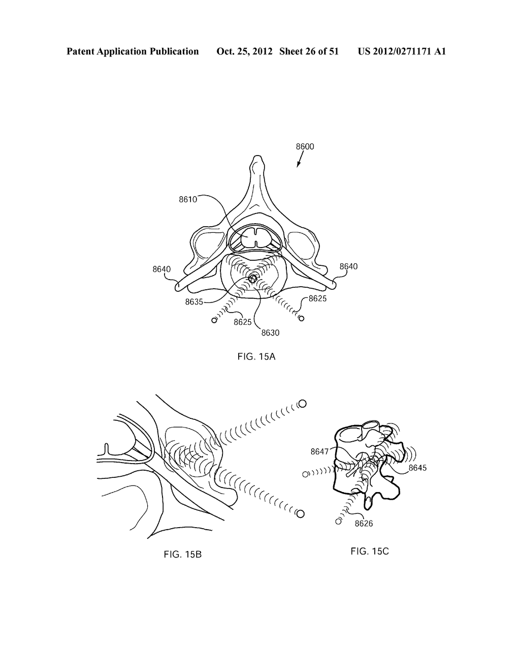 ENERGETIC MODULATION OF NERVES - diagram, schematic, and image 27