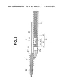 CATHETER diagram and image