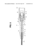 CATHETER diagram and image