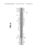 CATHETER diagram and image