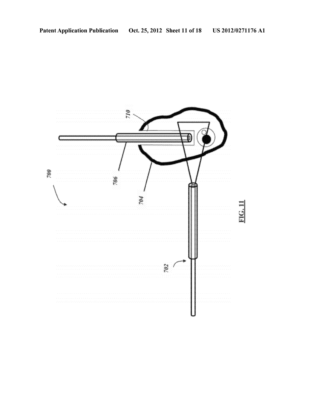 METHOD AND SYSTEM FOR OPTICALLY EVALUATING PROXIMITY TO THE INFERIOR     ALVEOLAR NERVE IN SITU - diagram, schematic, and image 12