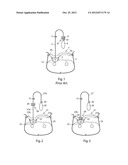 FEMORAL COMPRESSION DEVICE diagram and image