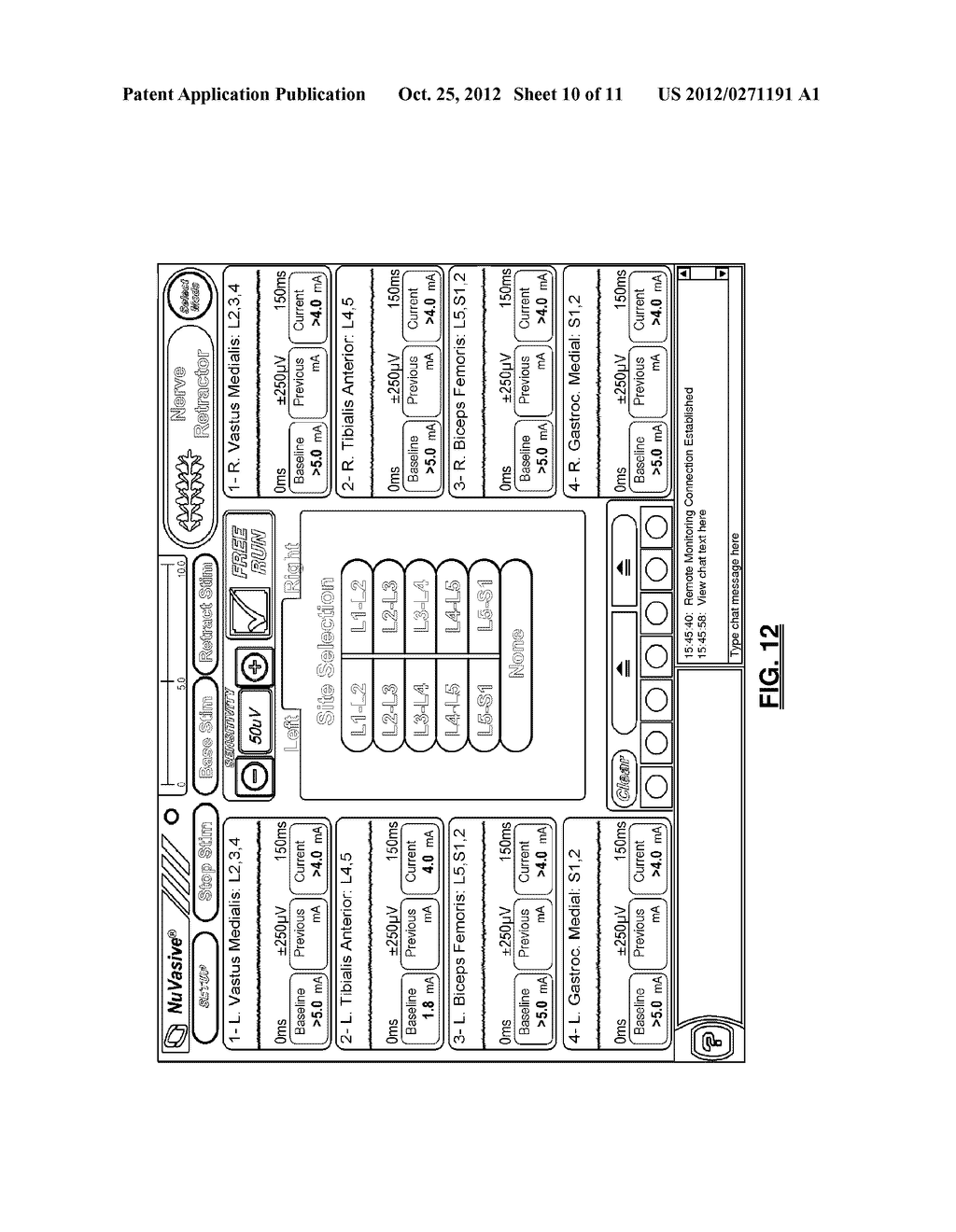 Multi-Channel Stimulation Detection Algorithm for Use with Neurophysiology     Monitoring Systems - diagram, schematic, and image 11