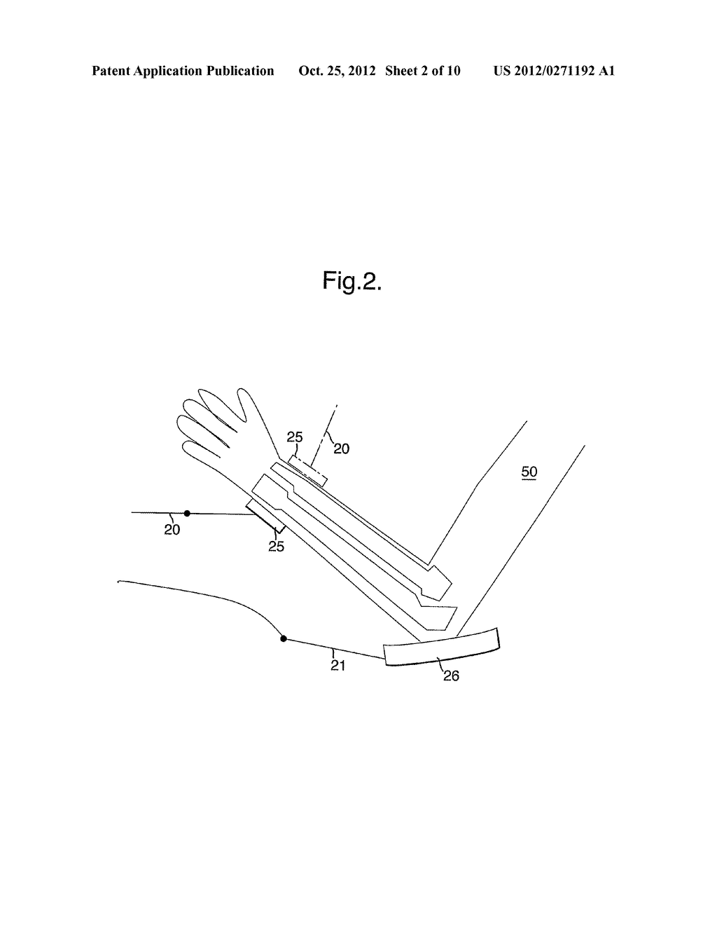 METHOD AND APPARATUS FOR ANALYSING THE STRUCTURE OF BONE TISSUE - diagram, schematic, and image 03