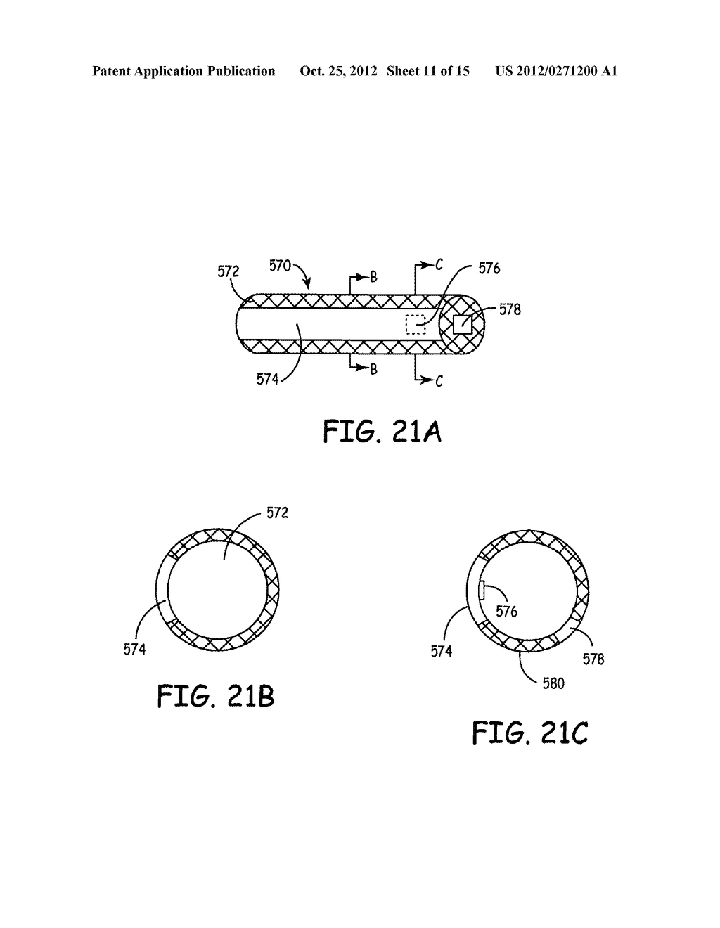 INSTRUMENTED IMPLANTABLE STENTS, VASCULAR GRAFTS AND OTHER MEDICAL DEVICES - diagram, schematic, and image 12