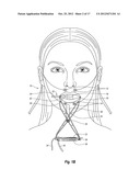 DEVICE, SYSTEM, AND METHOD FOR DETERMINATION OF ORAL/LIP STIFFNESS diagram and image