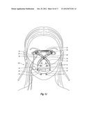 DEVICE, SYSTEM, AND METHOD FOR DETERMINATION OF ORAL/LIP STIFFNESS diagram and image