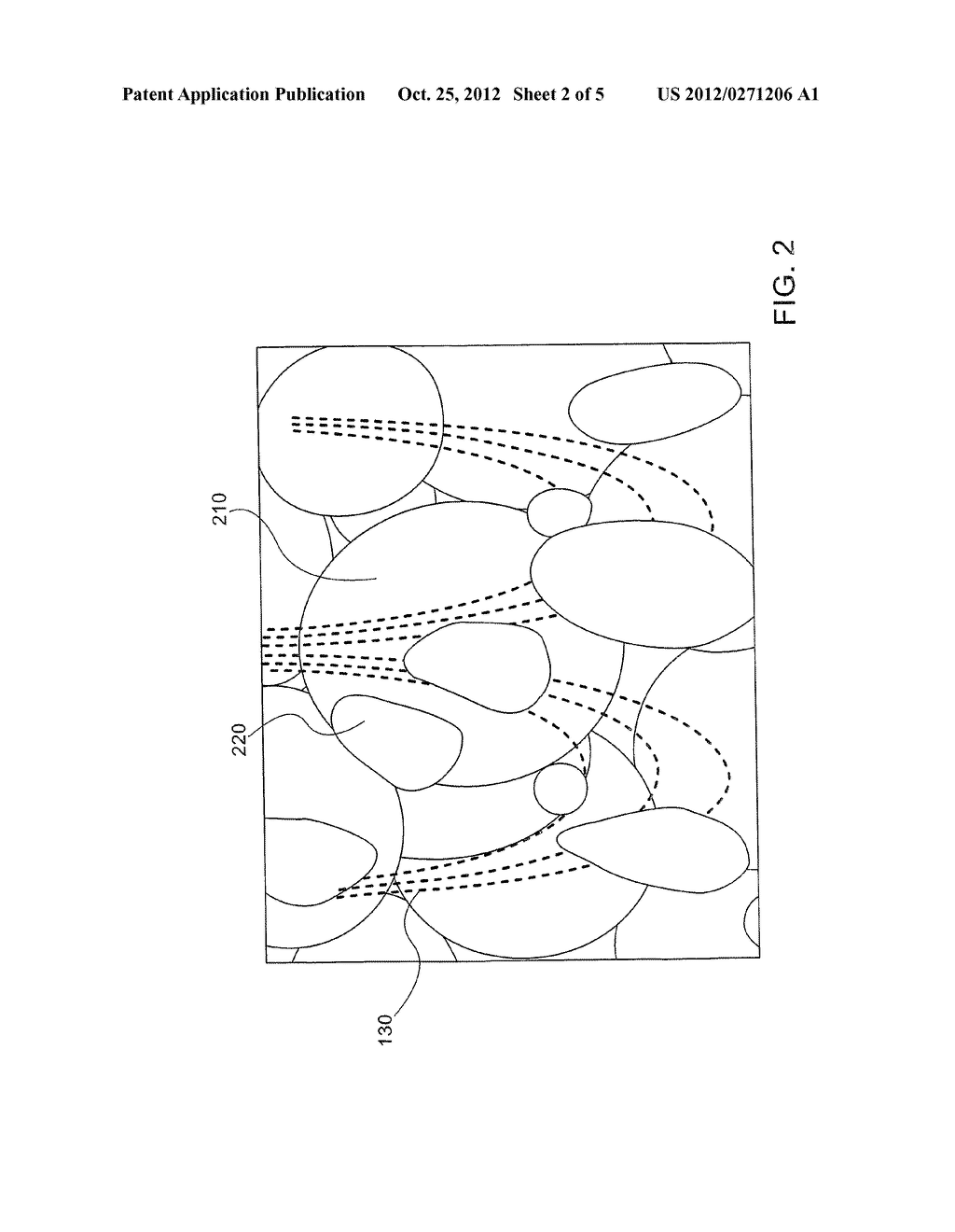 NON-INVASIVE FAT REMOVAL - diagram, schematic, and image 03