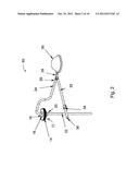 MANUAL IRRIGATION PUMP FOR INTRAPROCEDURAL IRRIGATION diagram and image