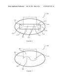 PRESSURE ACTUATED VALVE WITH IMPROVED SLIT CONFIGURATION diagram and image