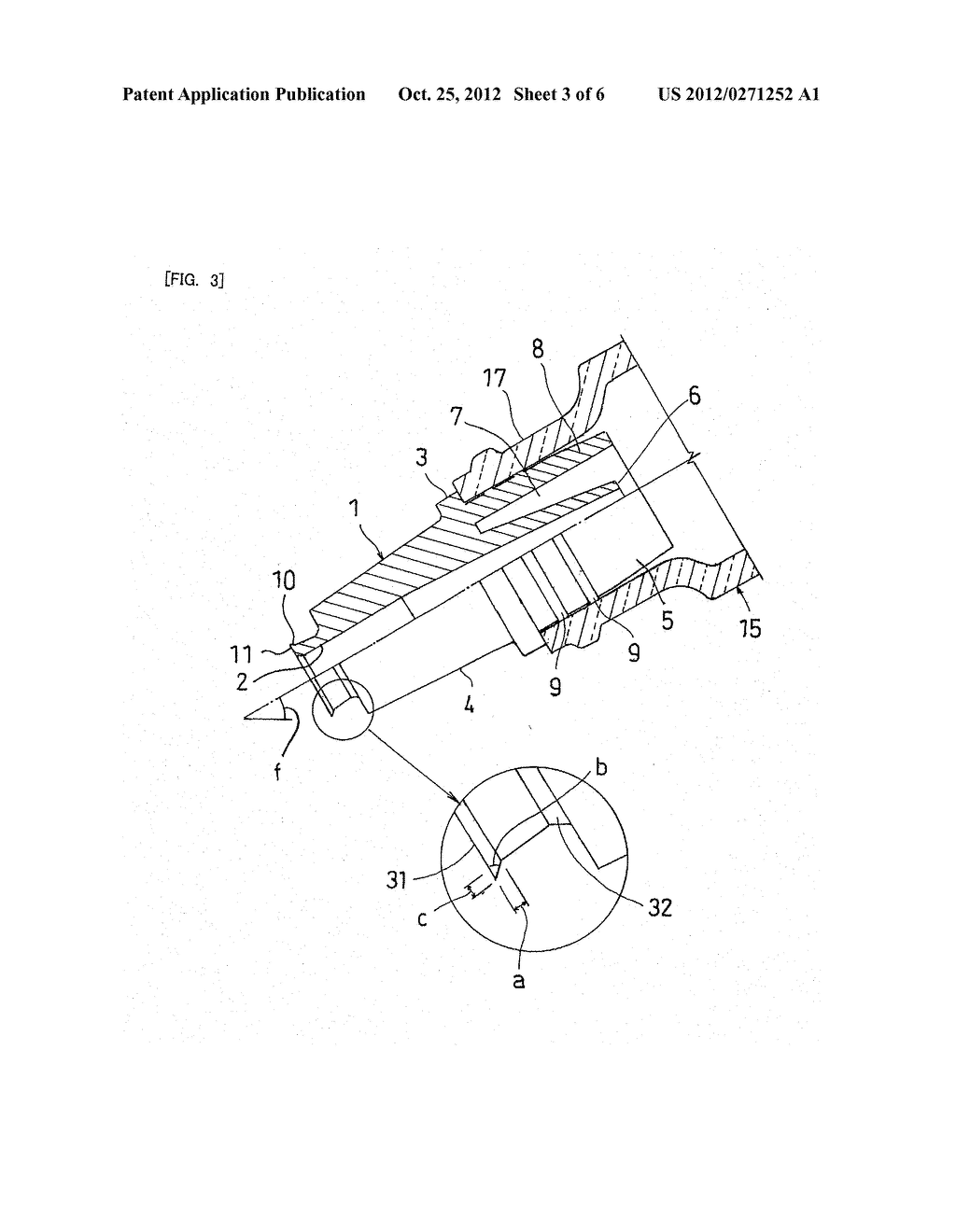 MEDICAL FLUID NOZZLE - diagram, schematic, and image 04