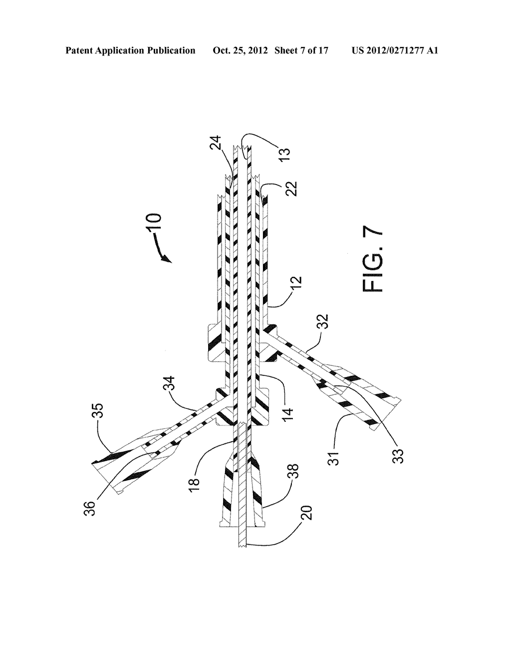 EXPANDABLE CATHETER SYSTEM FOR PERI-OSTIAL INJECTION AND MUSCLE AND NERVE     FIBER ABLATION - diagram, schematic, and image 08