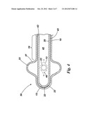 CATHETER diagram and image