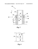 CATHETER diagram and image