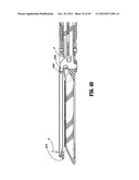 Surgical Instrument diagram and image