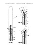 Surgical Instrument diagram and image