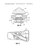 Surgical Instrument diagram and image