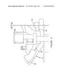 Method of Improved Vein Closure diagram and image