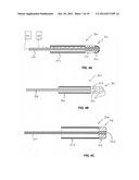 METHOD AND DEVICES FOR COAGULATION OF TISSUE diagram and image