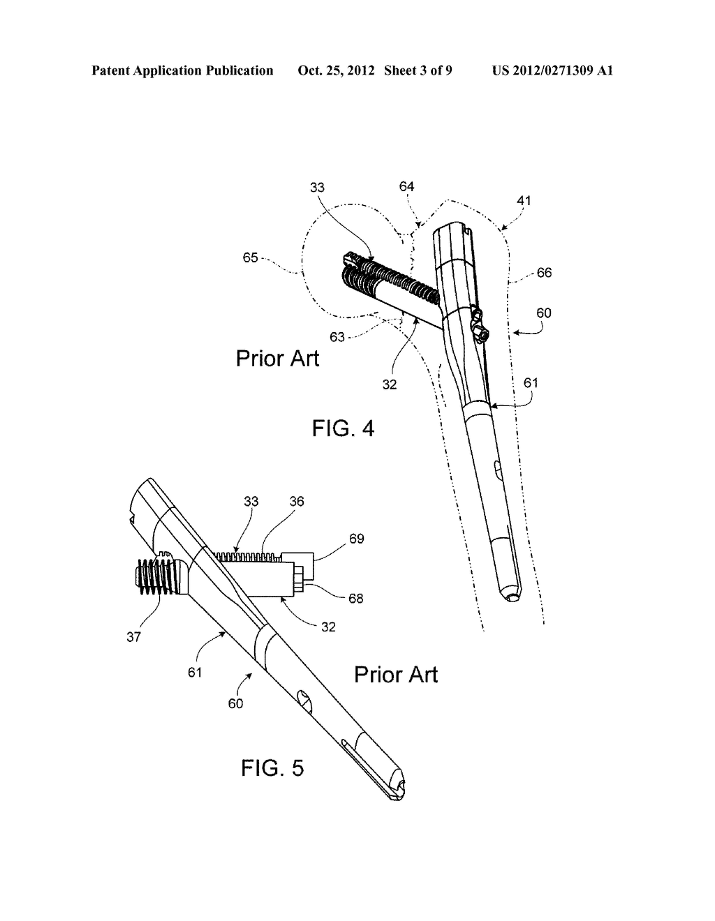 CONTROLLING BONE COMPRESSION - diagram, schematic, and image 04