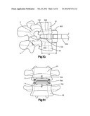 SPLINE ORIENTED INDEXING GUIDE diagram and image