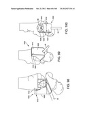 ORTHOPEDIC SURGICAL GUIDE diagram and image