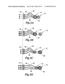 ROBOT FOR MINIMALLY INVASIVE INTERVENTIONS diagram and image