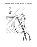 Devices and Methods for Continuous Surgical Suturing diagram and image