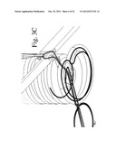 Devices and Methods for Continuous Surgical Suturing diagram and image