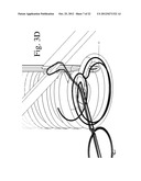 Devices and Methods for Continuous Surgical Suturing diagram and image