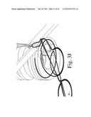 Devices and Methods for Continuous Surgical Suturing diagram and image