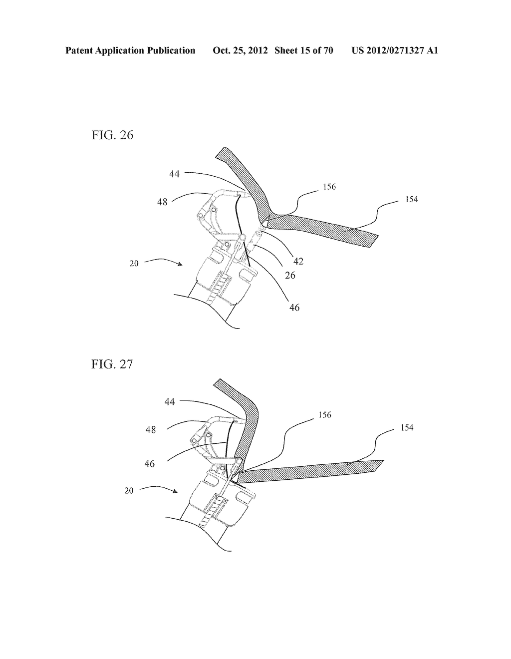 Endoscopic Tissue Grasping Systems and Methods - diagram, schematic, and image 16