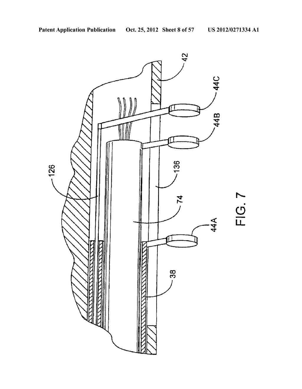 Apparatus and Method for Ablating Tissue - diagram, schematic, and image 09